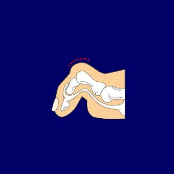 anim_hammertoes2
