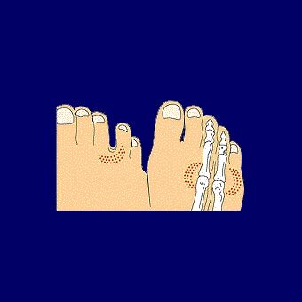 anim_plantar